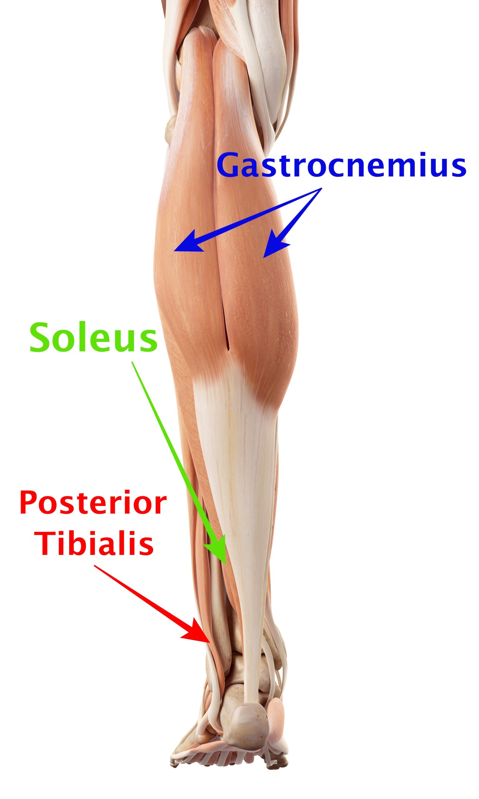 vector image of spastic ankle muscles