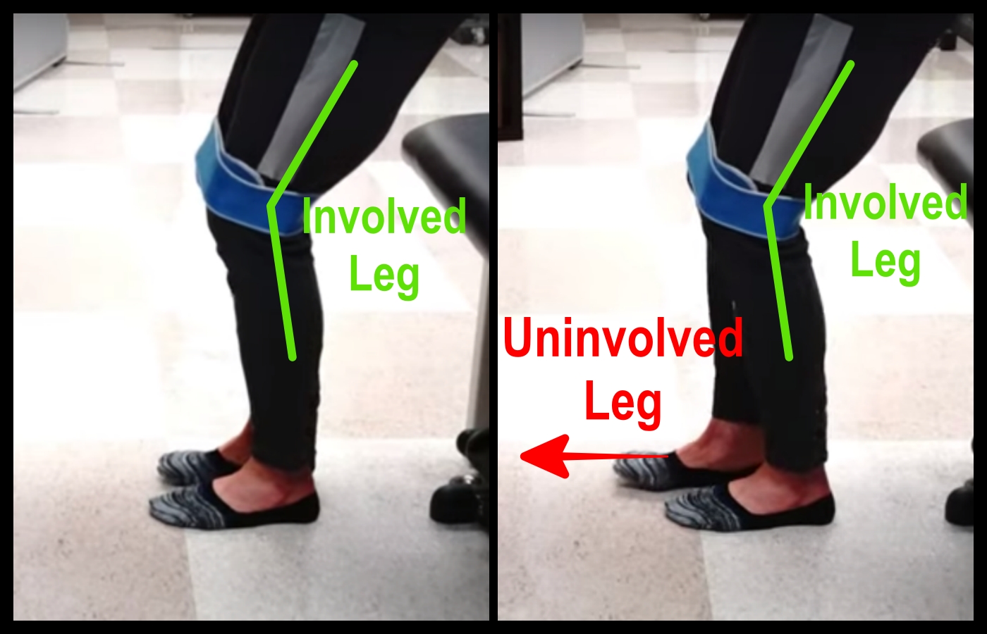 standing exercise for knee hyperextension
