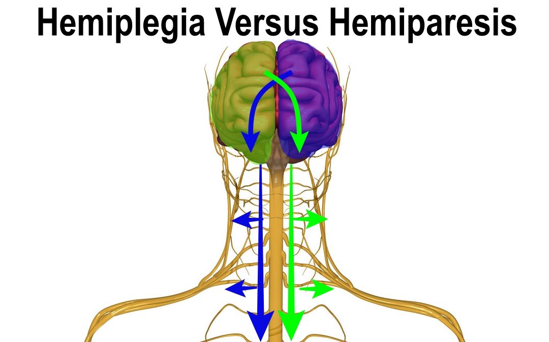 Hemiplegia Versus Hemiparesis