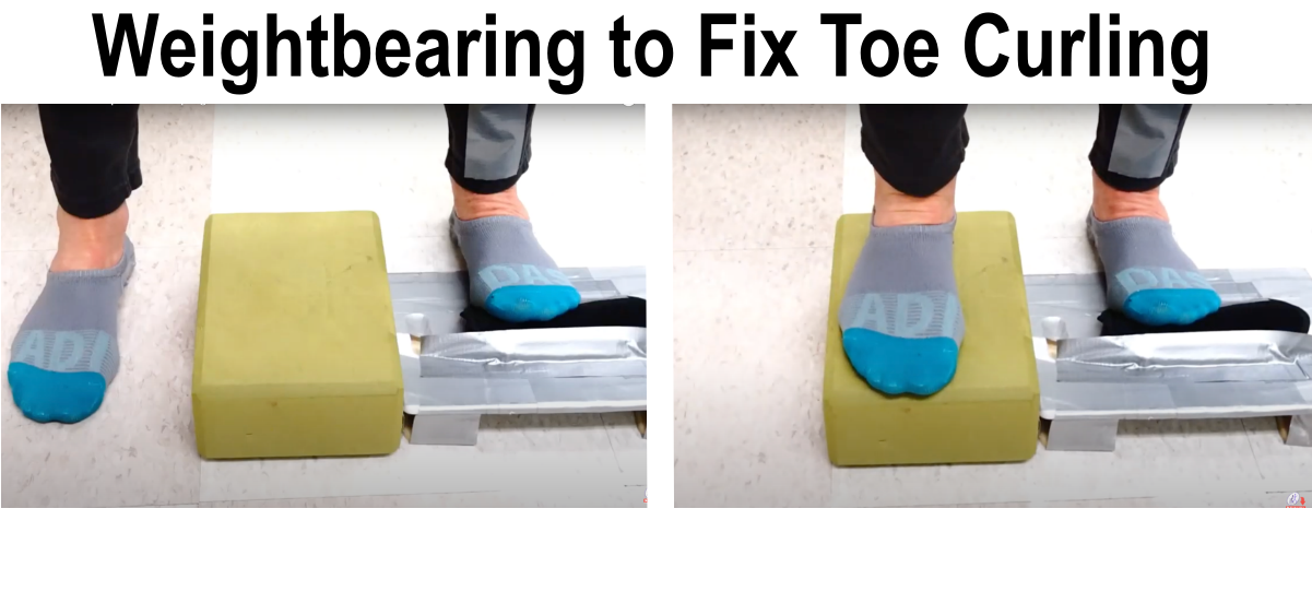 weightbearing exercise to reduce toe curling