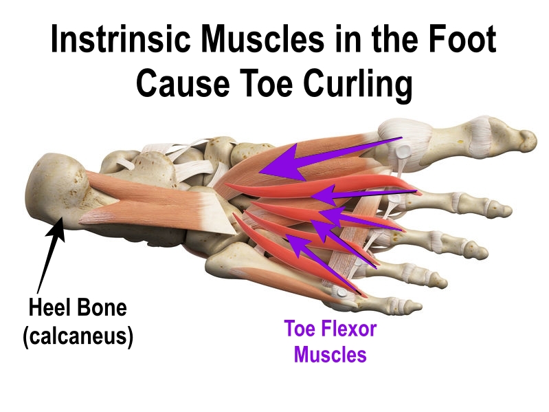 image of intrinsic foot muscles
