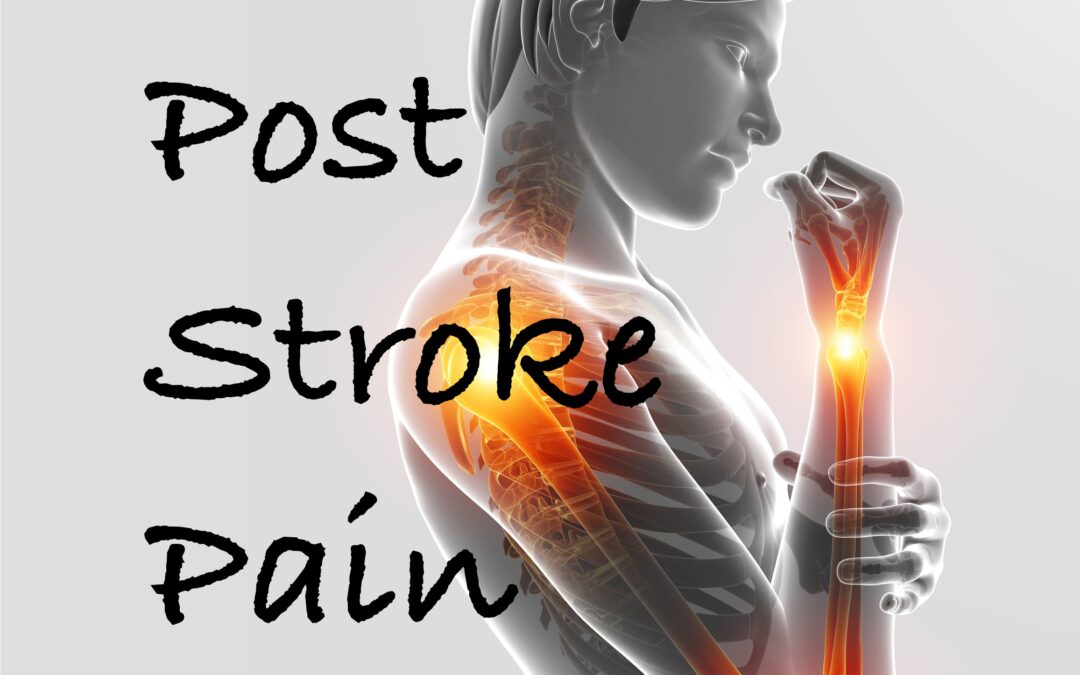 post stroke pain