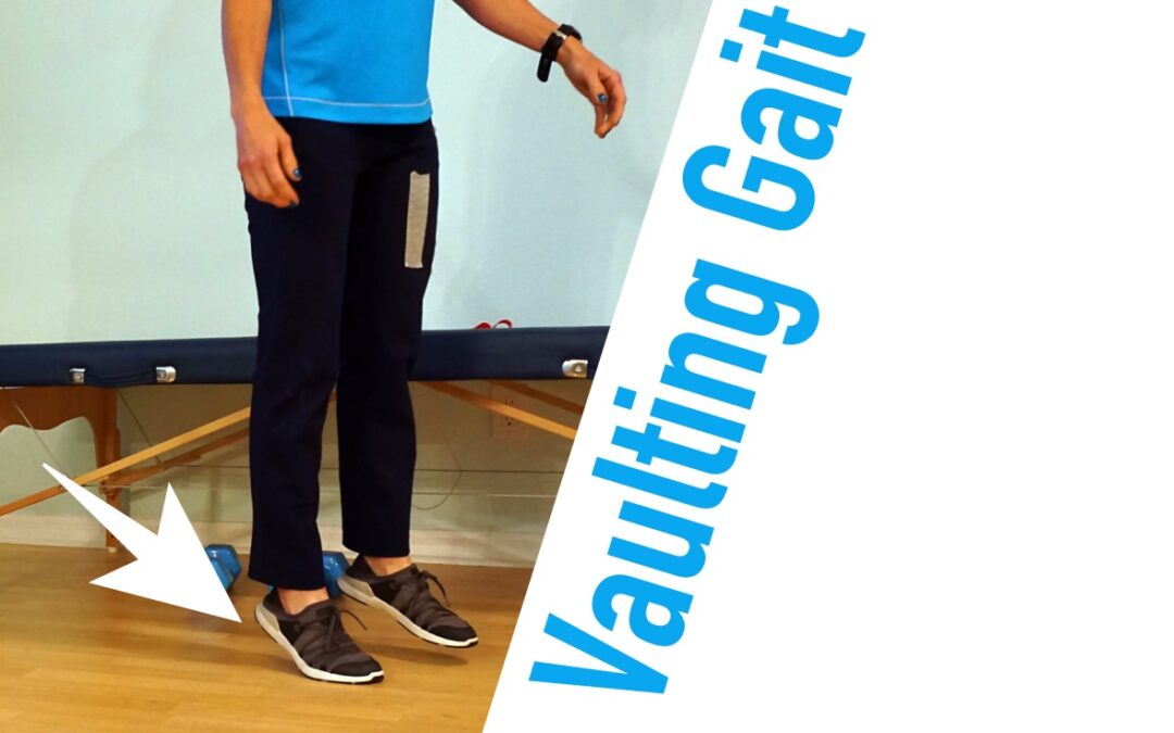 Vaulting Gait After a Stroke