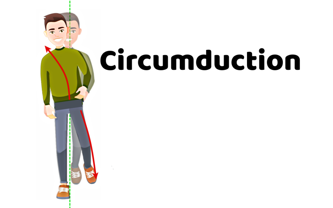 5 Problems that Lead to Circumduction