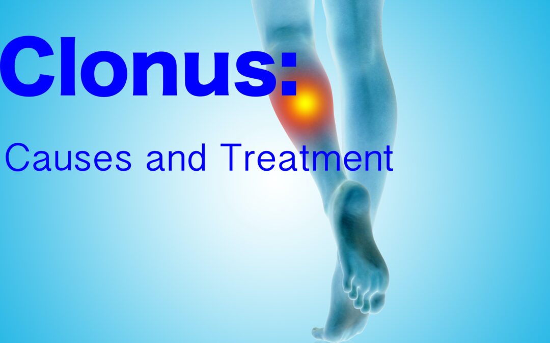 Clonus: Causes and Treatment