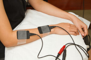 electrical stimulation on the arm