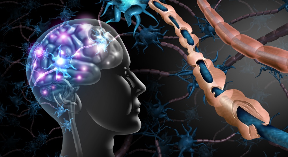 Brain Derived Neurotrophic Factor (BDNF) and Brain Health