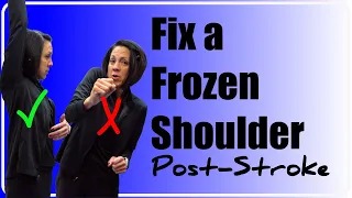 Fixing a “frozen shoulder” Post Stroke