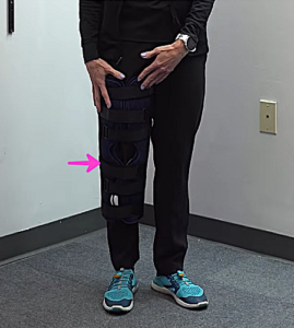 Image of Tara Tobias wearing a knee immobilizer on her right leg